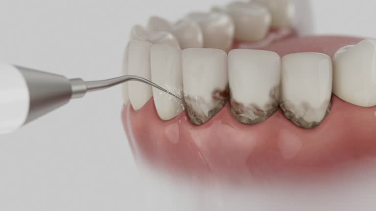 Reliable Dental Implants contractor in Red Oak, NC by Smile Center Dentistry